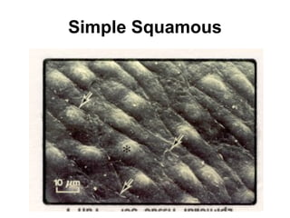 Simple Squamous 