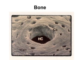 Bone 