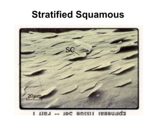 Stratified Squamous 