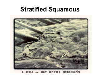 Stratified Squamous 