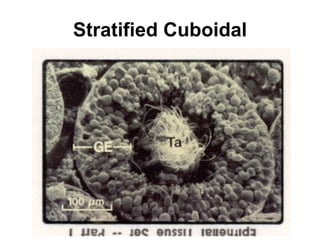 Stratified Cuboidal 