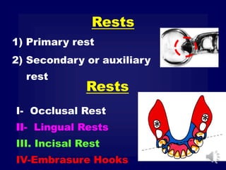 I- Occlusal Rest
II- Lingual Rests
III. Incisal Rest
IV-Embrasure Hooks
1) Primary rest
2) Secondary or auxiliary
rest
Rests
Rests
 
