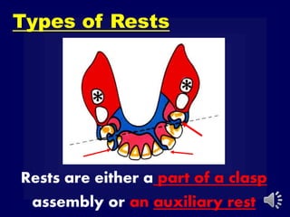 Rests are either a part of a clasp
assembly or an auxiliary rest
Types of Rests
 