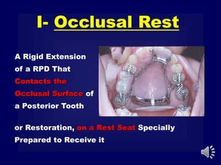 A Rigid Extension
of a RPD That
Contacts the
Occlusal Surface of
a Posterior Tooth
I- Occlusal Rest
or Restoration, on a Rest Seat Specially
Prepared to Receive it
 