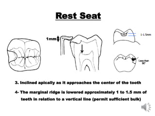 3. Inclined apically as it approaches the center of the tooth
4- The marginal ridge is lowered approximately 1 to 1.5 mm of
teeth in relation to a vertical line (permit sufficient bulk)
1mm
Rest Seat
 