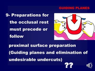 proximal surface preparation
(Guiding planes and elimination of
undesirable undercuts)
9- Preparations for
the occlusal rest
must precede or
follow
GUIDING PLANES
??
 
