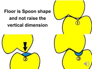 Floor is Spoon shape
and not raise the
vertical dimension
 