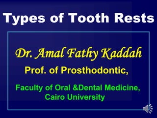 Dr. Amal Fathy Kaddah
Prof. of Prosthodontic,
Faculty of Oral &Dental Medicine,
Cairo University
Types of Tooth Rests
 