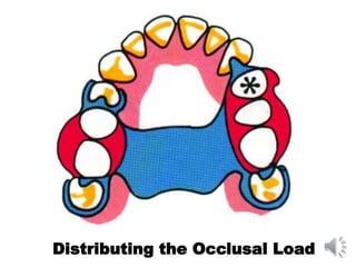 Distributing the Occlusal Load
 