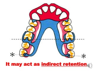 It may act as indirect retention
 
