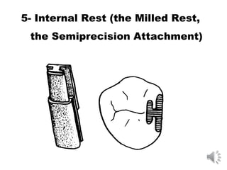 5- Internal Rest (the Milled Rest,
the Semiprecision Attachment)
 