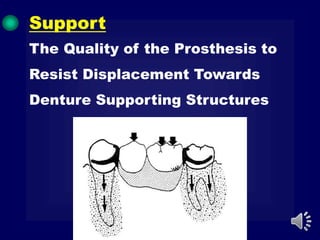 The Quality of the Prosthesis to
Resist Displacement Towards
Denture Supporting Structures
Support
 
