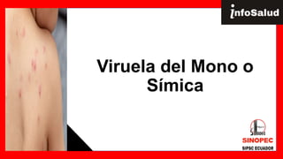 Viruela del Mono o
Símica
 