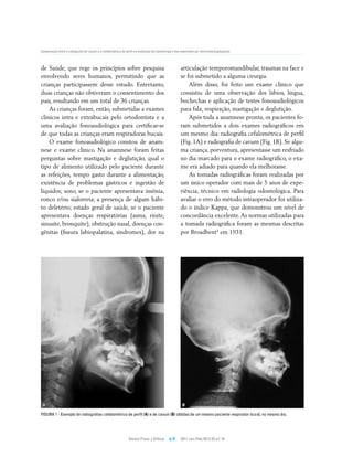 Comparação entre a radiografia de cavum e a cefalométrica de perfil na avaliação da nasofaringe e das adenoides por otorrinolaringologistas




de Saúde, que rege os princípios sobre pesquisa                                                       articulação temporomandibular, traumas na face e
envolvendo seres humanos, permitindo que as                                                           se foi submetido a alguma cirurgia.
crianças participassem desse estudo. Entretanto,                                                          Além disso, foi feito um exame clínico que
duas crianças não obtiveram o consentimento dos                                                       consistiu de uma observação dos lábios, língua,
pais, resultando em um total de 36 crianças.                                                          bochechas e aplicação de testes fonoaudiológicos
    As crianças foram, então, submetidas a exames                                                     para fala, respiração, mastigação e deglutição.
clínicos intra e extrabucais pelo ortodontista e a                                                        Após toda a anamnese pronta, os pacientes fo-
uma avaliação fonoaudiológica para certificar-se                                                      ram submetidos a dois exames radiográficos em
de que todas as crianças eram respiradoras bucais.                                                    um mesmo dia: radiografia cefalométrica de perfil
    O exame fonoaudiológico constou de anam-                                                          (Fig. 1A) e radiografia de cavum (Fig. 1B). Se algu-
nese e exame clínico. Na anamnese foram feitas                                                        ma criança, porventura, apresentasse um resfriado
perguntas sobre mastigação e deglutição, qual o                                                       no dia marcado para o exame radiográfico, o exa-
tipo de alimento utilizado pelo paciente durante                                                      me era adiado para quando ela melhorasse.
as refeições, tempo gasto durante a alimentação,                                                          As tomadas radiográficas foram realizadas por
existência de problemas gástricos e ingestão de                                                       um único operador com mais de 5 anos de expe-
líquidos; sono, se o paciente apresentava insônia,                                                    riência, técnico em radiologia odontológica. Para
ronco e/ou sialorreia; a presença de algum hábi-                                                      avaliar o erro do método intraoperador foi utiliza-
to deletério; estado geral de saúde, se o paciente                                                    do o índice Kappa, que demonstrou um nível de
apresentava doenças respiratórias (asma, rinite,                                                      concordância excelente. As normas utilizadas para
sinusite, bronquite), obstrução nasal, doenças con-                                                   a tomada radiográfica foram as mesmas descritas
gênitas (fissura labiopalatina, síndromes), dor na                                                    por Broadbent4 em 1931.




 A                                                                                                      B

FiguRA 1 - Exemplo de radiografias cefalométrica de perfil (A) e de cavum (B) obtidas de um mesmo paciente respirador bucal, no mesmo dia.




                                                                Dental Press J Orthod         e.4     2011 Jan-Feb;16(1):32.e1-10
 