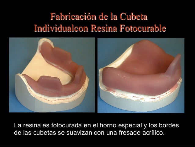 06. fabricacion de la cubeta para impresion