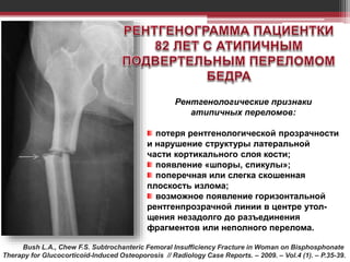 Рентгенологические признаки
атипичных переломов:
потеря рентгенологической прозрачности
и нарушение структуры латеральной
части кортикального слоя кости;
появление «шпоры, спикулы»;
поперечная или слегка скошенная
плоскость излома;
возможное появление горизонтальной
рентгенпрозрачной линии в центре утол-
щения незадолго до разъединения
фрагментов или неполного перелома.
Bush L.A., Chew F.S. Subtrochanteric Femoral Insufficiency Fracture in Woman on Bisphosphonate
Therapy for Glucocorticoid-Induced Osteoporosis // Radiology Case Reports. – 2009. – Vol.4 (1). – P.35-39.
 