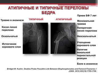 Bridget M. Kuehn. Studies Probe Possible Link Between Bisphosphonates and Femoral Fractures //
JAMA. 2010;303(18):1795-1796.
Прием БФ 7 лет
Минимальная
травма
Поперечная
линия перелома
Неоскольчатый
Утолщение
коркового слоя
Боли в анамнезе
Травма в анамнезе
Косая линия
перелома
Оскольчатый
Истончение
коркового слоя
Наличие
локальной
периостальной
реакции
 