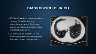 DIAGNOSTICO CLINICO
• TAC de tórax con contraste muestra
tumores de lesión típica con
alimentación y venas de drenaje,
aunque en cáncer de pulmón puede
causar falsos positivos.
• La perfusión de Tecnecio 95 con
macroagregado de albumina puede
identificar shunt intrapulmonar.
 