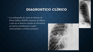 DIAGNOSTICO CLÍNICO
• La radiografía de tórax no detecta de
forma fiables MAVPs menores de 20mm
o que no se detecte cuando se encuentra
en surcos costofrénicos, región
retrocardiaca o el hilio proximal.
 