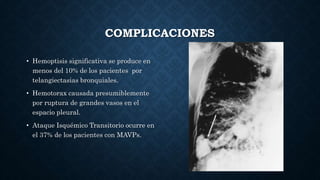 COMPLICACIONES
• Hemoptisis significativa se produce en
menos del 10% de los pacientes por
telangiectasias bronquiales.
• Hemotorax causada presumiblemente
por ruptura de grandes vasos en el
espacio pleural.
• Ataque Isquémico Transitorio ocurre en
el 37% de los pacientes con MAVPs.
 