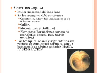  ÁRBOL BRONQUIAL
 Iniciar inspección del lado sano
 En los bronquios debe observarse
 Orientación, si hay desplazamientos de su
ubicación normal.
 Calibre
 Mucosa (Lisa y Brillante)
 Elementos (Formaciones tumorales,
secreciones, sangre, pus, cuerpo
extraños,)
 Los bronquios lobares y segmentarios son
visibles, en condiciones normales, con un
broncoscoío de adultos estándar HASTA
IV GENERACIÓN.
 