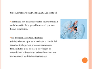 ULTRASONIDO ENDOBRONQUIAL (EBUS)
Establece con alta sensibilidad la profundidad
de la invasión de la pared bronquial por una
lesión neoplásica.
Se desarrolla con transductores
miniaturizados que se introducen a través del
canal de trabajo. Las ondas de sonido son
transmitidas a los tejidos y se reflejan de
acuerdo con la impedancia de cada estructura
que compone los tejidos subyacentes.
 