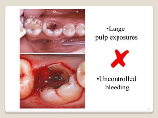15
•Large
pulp exposures
•Uncontrolled
bleeding
 