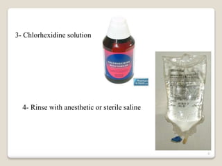 41
3- Chlorhexidine solution
4- Rinse with anesthetic or sterile saline
 