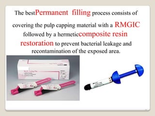 The bestPermanent filling process consists of
covering the pulp capping material with a RMGIC
followed by a hermeticcomposite resin
restoration to prevent bacterial leakage and
recontamination of the exposed area.
46
 