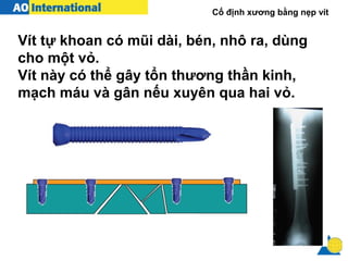 Cố định xương bằng nẹp vít
Vít tự khoan có mũi dài, bén, nhô ra, dùng
cho một vỏ.
Vít này có thể gây tổn thương thần kinh,
mạch máu và gân nếu xuyên qua hai vỏ.
 