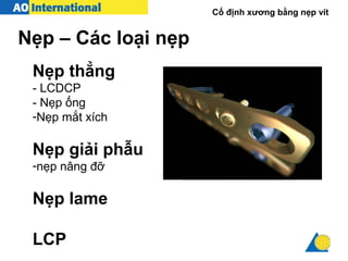 Cố định xương bằng nẹp vít
Nẹp thẳng
- LCDCP
- Nẹp ống
-Nẹp mắt xích
Nẹp giải phẫu
-nẹp nâng đỡ
Nẹp lame
LCP
Nẹp – Các loại nẹp
 