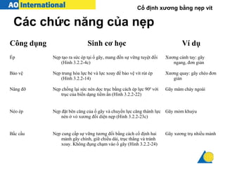 Các chức năng của nẹp
Cố định xương bằng nẹp vít
Công dụng Sinh cơ học Ví dụ
Ép Nẹp tạo ra sức ép tại ổ gãy, mang đến sự vững tuyệt đối
(Hình 3.2.2-4c)
Xương cánh tay: gãy
ngang, đơn giản
Bảo vệ Nẹp trung hòa lực bẻ và lực xoay để bảo vệ vít rút ép
(Hình 3.2.2-14)
Xương quay: gãy chéo đơn
giản
Nâng đỡ Nẹp chống lại sức nén dọc trục bằng cách ép lực 900
với
trục của biến dạng tiềm ẩn (Hình 3.2.2-22)
Gãy mâm chày ngoài
Néo ép Nẹp đặt bên căng của ổ gãy và chuyển lực căng thành lực
nén ở vỏ xương đối diện nẹp (Hình 3.2.2-23c)
Gãy mỏm khuỷu
Bắc cầu Nẹp cung cấp sự vững tương đối bằng cách cố định hai
mảnh gãy chính, giữ chiều dài, trục thẳng và tránh
xoay. Không đụng chạm vào ổ gãy (Hình 3.2.2-24)
Gãy xương trụ nhiều mảnh
 