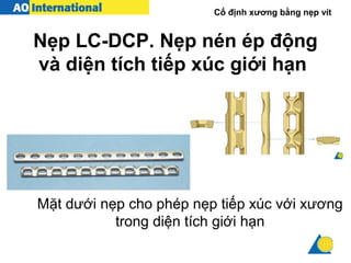 Cố định xương bằng nẹp vít
Nẹp LC-DCP. Nẹp nén ép động
và diện tích tiếp xúc giới hạn
Mặt dưới nẹp cho phép nẹp tiếp xúc với xương
trong diện tích giới hạn
 