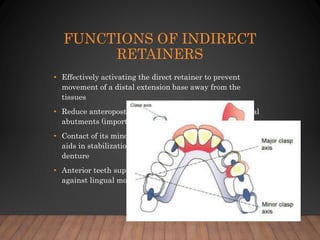 06. indirect retainers and biomechanics | PPTX