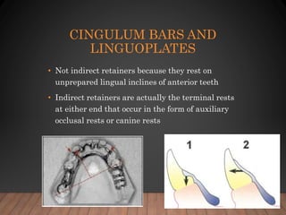 06. indirect retainers and biomechanics | PPTX | Dental Health ...