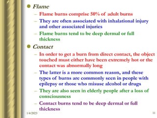 06.A BURN INJURY-DR PHILLIP BMC 1.ppt