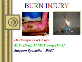 BURN INJURY
Dr Phillipo Leo Chalya
M.D. [Dar]; M.MED surg [Mak]
Surgeon Specialist - BMC
 