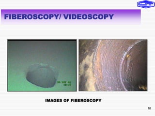 18
FIBEROSCOPY/ VIDEOSCOPY
IMAGES OF FIBEROSCOPY
 
