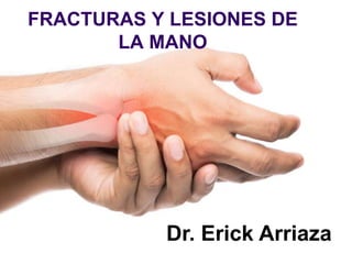 FRACTURAS Y LESIONES DE
LA MANO
Dr. Erick Arriaza
 