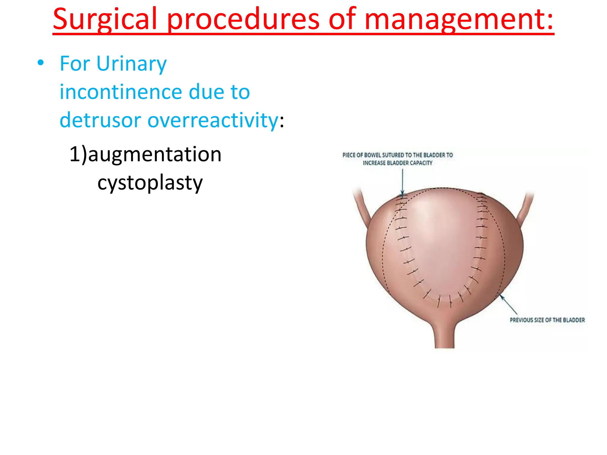 06.05.21-neurogenic-bladder-and-Copy.pdf