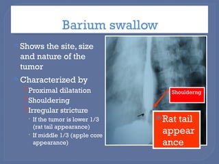 .ESOPHAGEAL CANCER.DEFINTIONS , ANATOMY , CLASSIFICATIONS AND ...