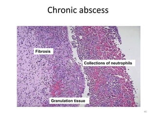 06. Chronic Inflammation 1.for medicine and healthcare | PDF