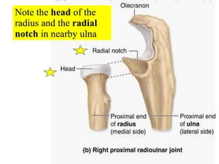 Note the  head  of the radius and the  radial notch  in nearby ulna 