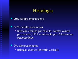 Histologia
 90% células transicionais90% células transicionais
 3-7% células escamosas3-7% células escamosas
 Infecção crônica por cálculo, cateter vesicalInfecção crônica por cálculo, cateter vesical
permanente, ITU ou infecção porpermanente, ITU ou infecção por SchistosomaSchistosoma
haematobiumhaematobium
 2% adenocarcinoma2% adenocarcinoma
 Irritação crônica (extrofia vesical)Irritação crônica (extrofia vesical)
 