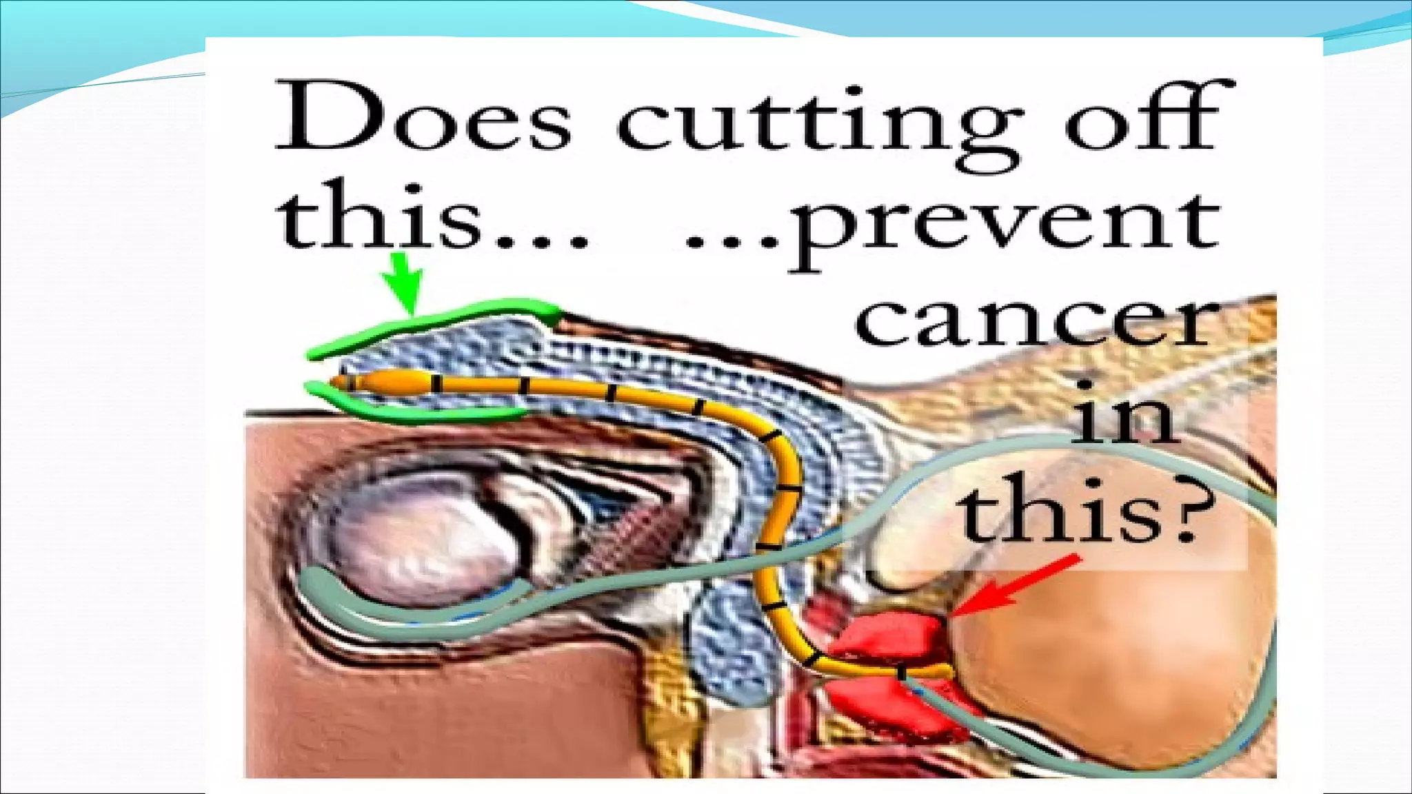 Chikezie Emele: Robert Gordon University