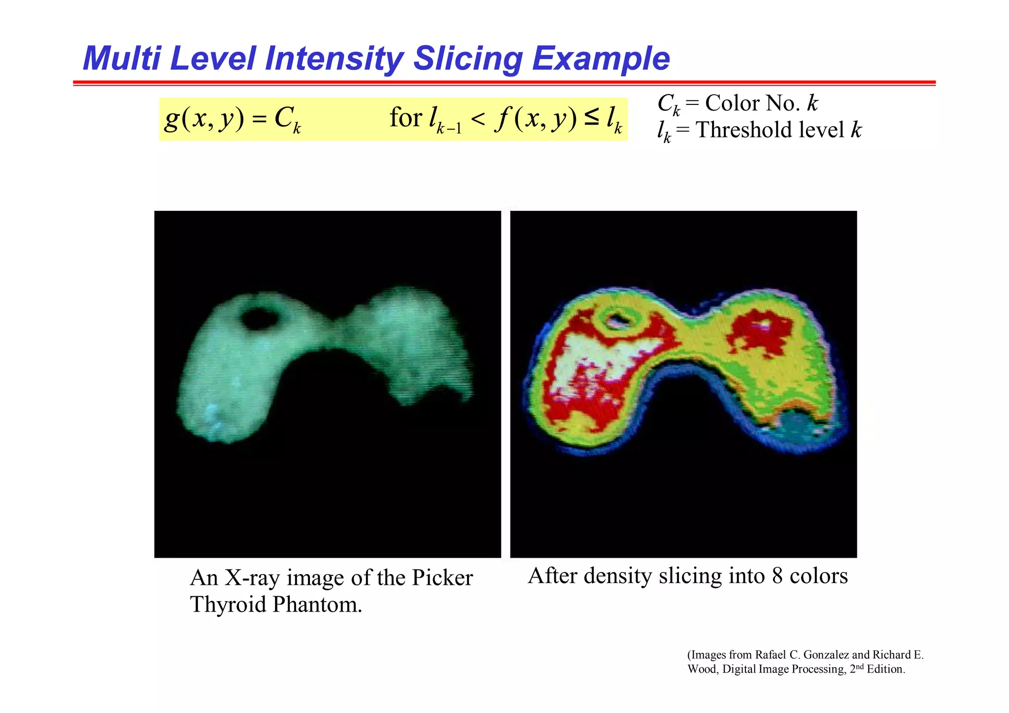 (Images from Rafael C. Gonzalez and Richard E.
Wood, Digital Image Processing, 2nd Edition.
Multi Level Intensity Slicing Example
Multi Level Intensity Slicing Example
k
k
k l
y
x
f
l
C
y
x
g ≤
<
= − )
,
(
for
)
,
( 1
Ck = Color No. k
lk = Threshold level k
An X-ray image of the Picker
Thyroid Phantom.
After density slicing into 8 colors
 