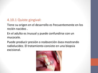 4.10.1 Quiste gingival:
Tiene su origen en el desarrollo es frecuentemente en los
recién nacidos .
En el adulto es inusual y puede confundirse con un
mucocele.
Puede producir presión o reabsorción ósea mostrando
radiolucidez. El tratamiento consiste en una biopsia
excisional.
 