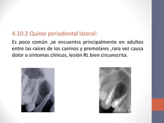 4.10.2 Quiste periodontal lateral:
Es poco común ,se encuentra principalmente en adultos
entre las raíces de los caninos y premolares ,rara vez causa
dolor o síntomas clínicos, lesión RL bien circunscrita.
 