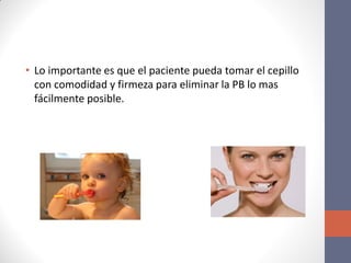 • Lo importante es que el paciente pueda tomar el cepillo
con comodidad y firmeza para eliminar la PB lo mas
fácilmente posible.
 