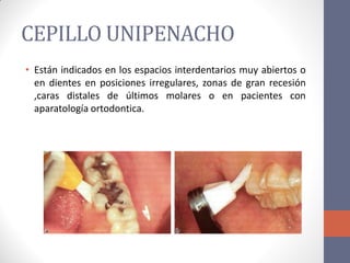CEPILLO UNIPENACHO
• Están indicados en los espacios interdentarios muy abiertos o
en dientes en posiciones irregulares, zonas de gran recesión
,caras distales de últimos molares o en pacientes con
aparatología ortodontica.
 